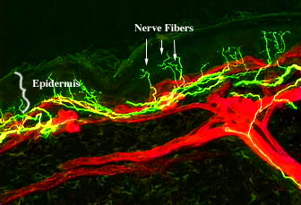 section of a biopsy captured on a confocal microscope