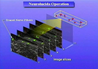 Neurolucida operation diagram